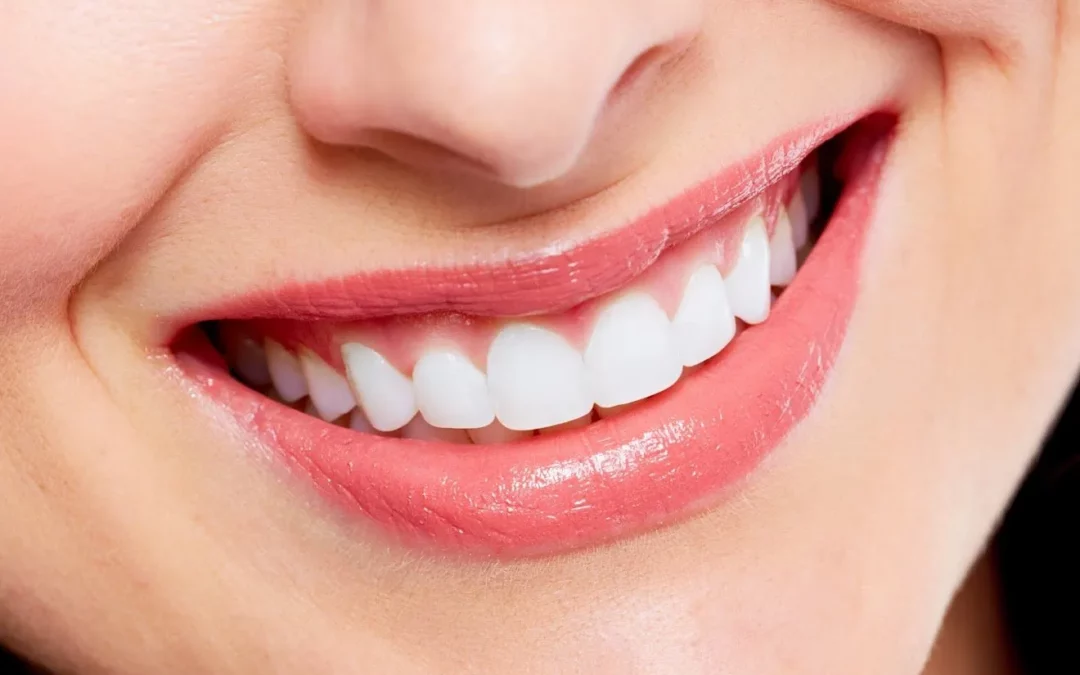 Why Your Teeth are Discoloured & How You Can Get Them White Again